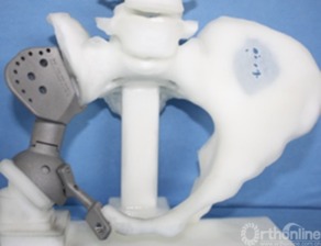 三維打印技術(shù)在硬組織外科臨床醫(yī)學(xué)中的應(yīng)用現(xiàn)狀與未來展望